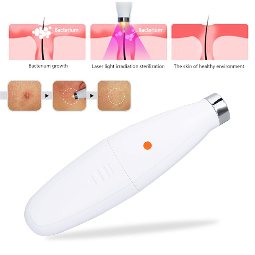 Acne Remover Soft Scar Laser Pen
