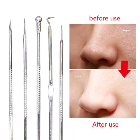Facial Care Blackhead And Pimple Remover