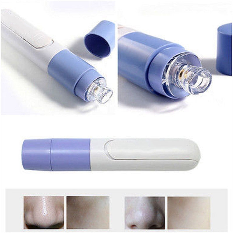 Mini Electric Facial Pore Cleanser