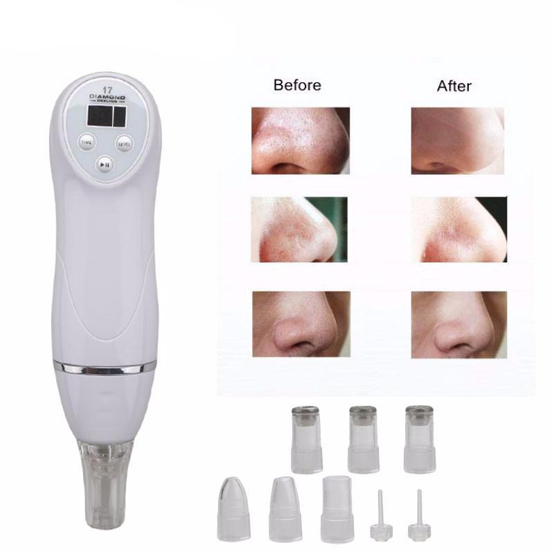 Acne Remover Facial Pore Cleaner